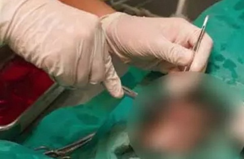 दुर्ग जिला अस्पताल में दर्दनाक हादसा: नसबंदी के दौरान दो महिलाओं की मौत, दवा के रिएक्शन की आशंका