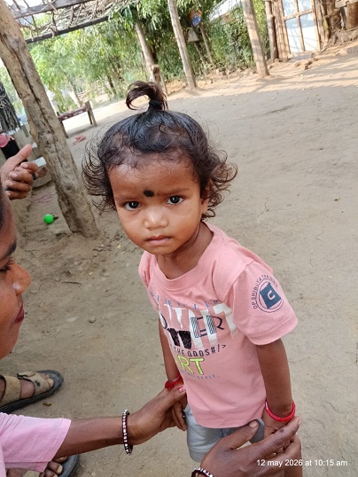 व्यवस्था की सजगता और परिवार के संकल्प से नन्ही शान्वी ने दी गंभीर कुपोषण को मात