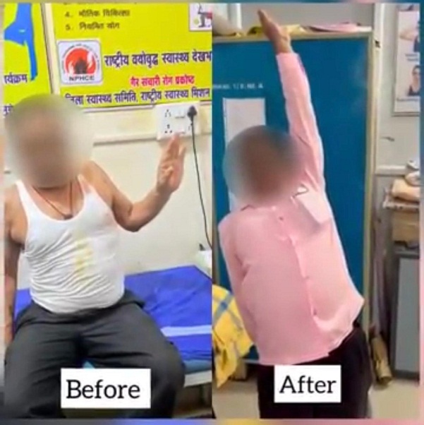 स्वास्थ्य सेवाओं में क्रांति: मुंगेली जिला चिकित्सालय बना अंतरराज्यीय मरीजों के लिए ‘संजीवनी’, फिजियोथेरेपी विभाग ने बदली सैकड़ों जिंदगियां