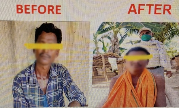 कुष्ठ रोग का समय पर इलाज से कैसे बागबाहरा के किसान को मिली नई जिंदगी?