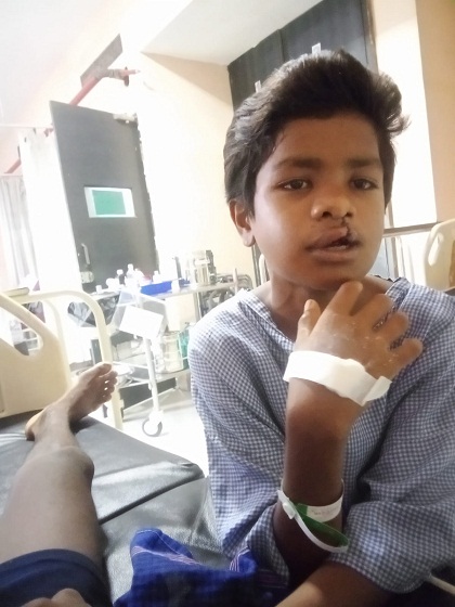 ‘चिरायु’ दल ने लौटाई मुस्कान, जन्मजात कटे होंठ और तालु से मिली मुक्ति