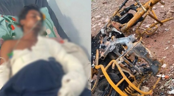 शराब पार्टी के बहाने बुलाकर दोस्त को पेट्रोल से जिंदा फूंका, 7 दिन बाद तोड़ा दम